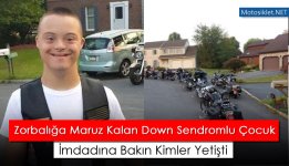 Down-Sendromlu-Cocuk.jpg